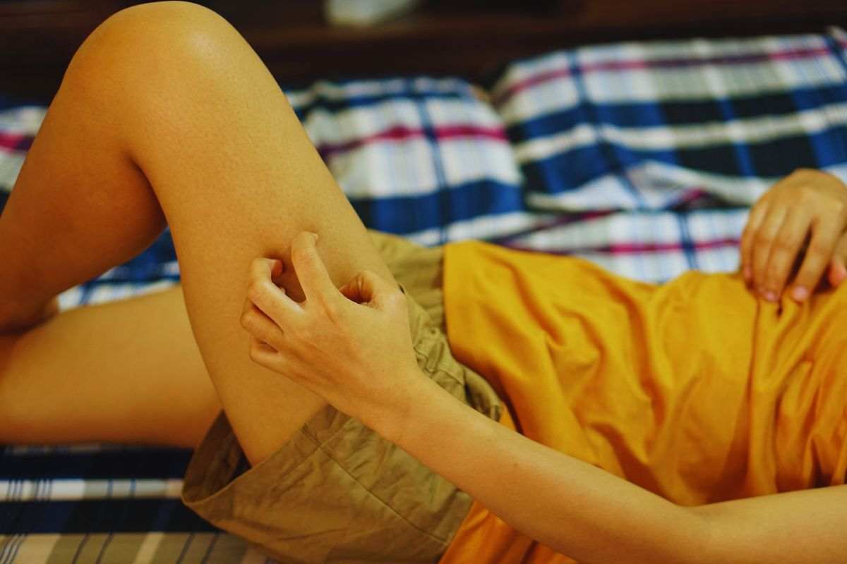 il problema del prurito alle gambe