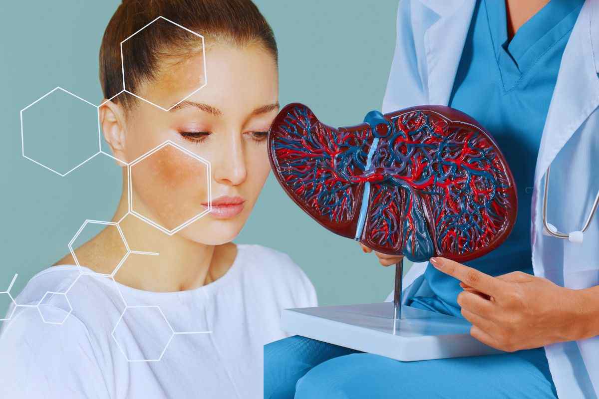 i seganli cutanei di problemi al fegato